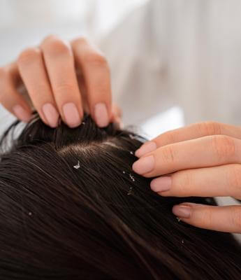 Hair Dandruff Treatment
